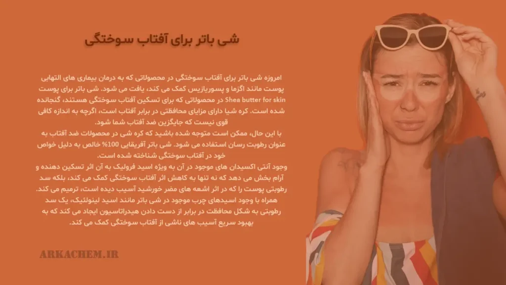 شی باتر برای آفتاب سوختگی