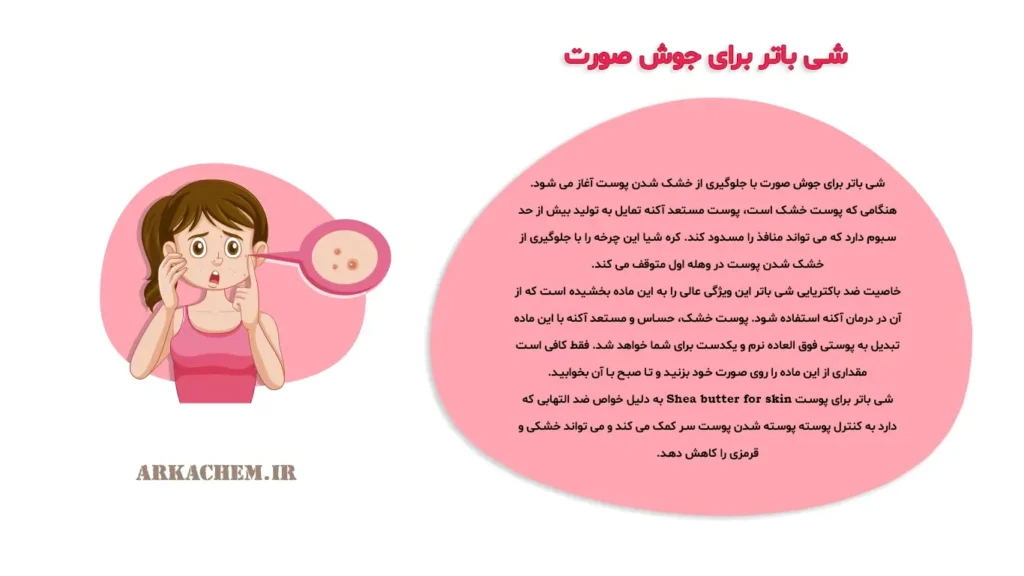 شی باتر برای جوش صورت