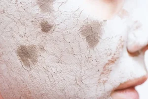 چطور سد دفاعی پوست را بالا ببریم؟