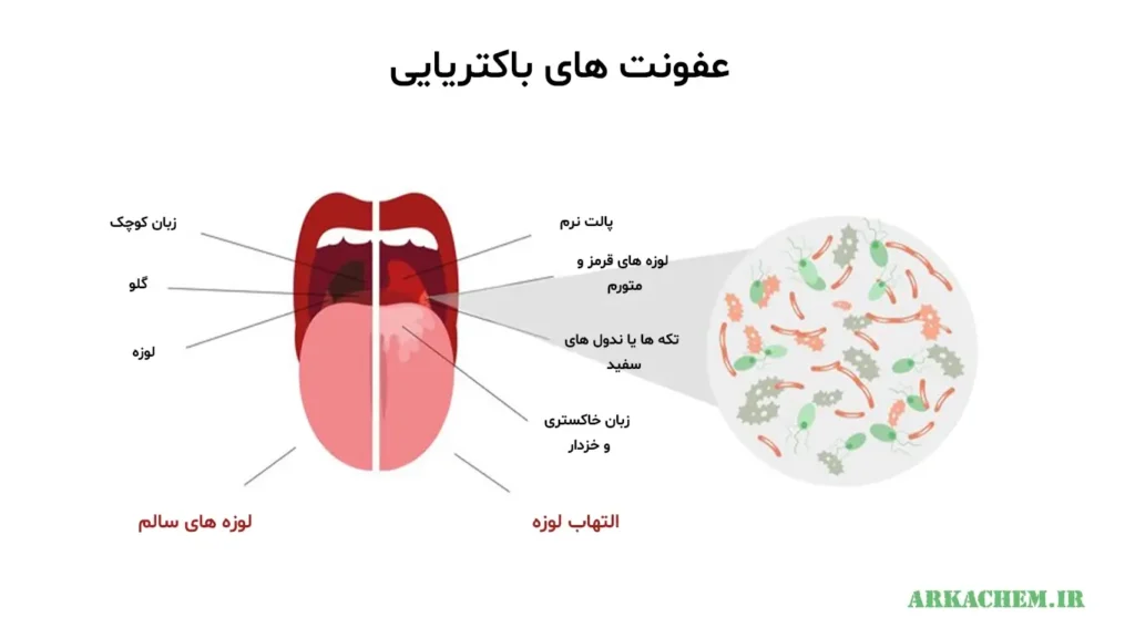 بیوفیلم دندانی